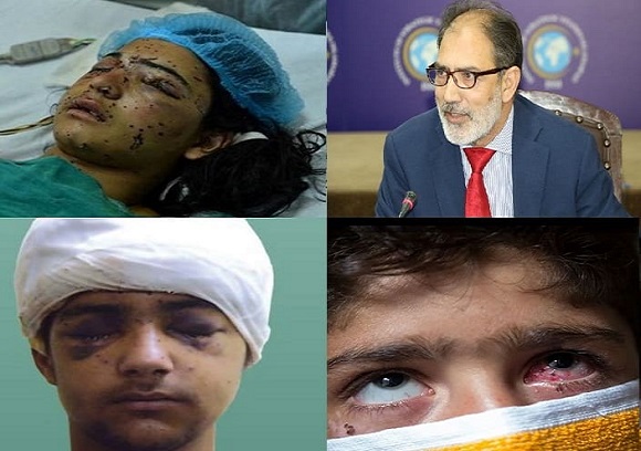 التكلفة البشرية للقوة «غير المميتة» في كشمير